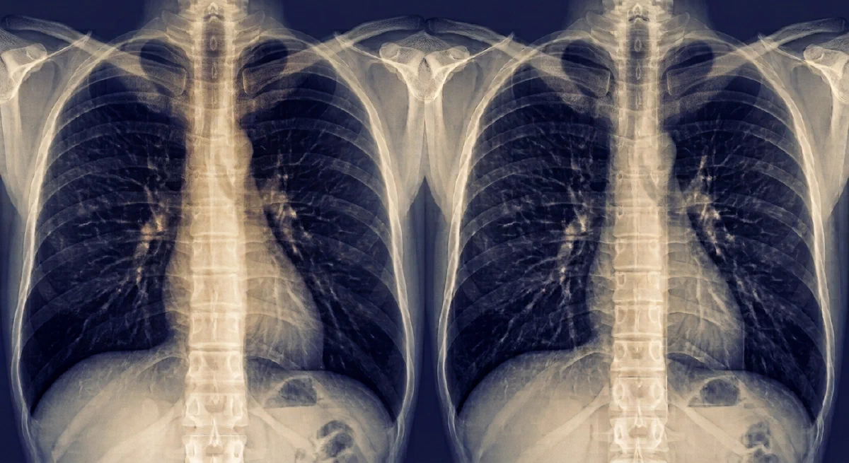 Out Of Breath